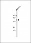 YY1 Antibody (Center)